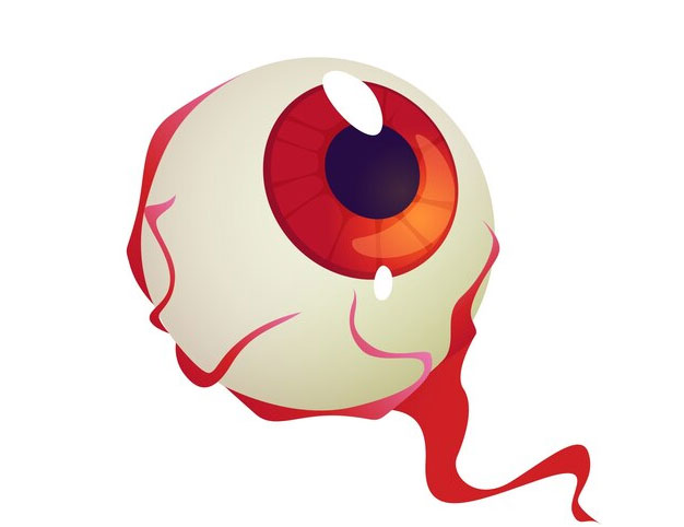 Čo spôsobuje krvavé oči