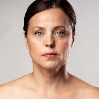 Wie können wir Gesichtsfalten wirksam beseitigen?